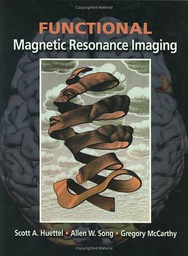 Functional Magnetic Resonance Imaging